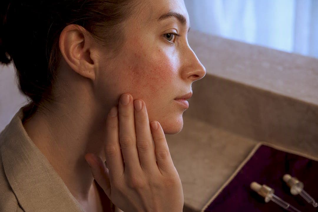 Gentle First: When Lactic Acid Beats Retinol for Reactive Skin